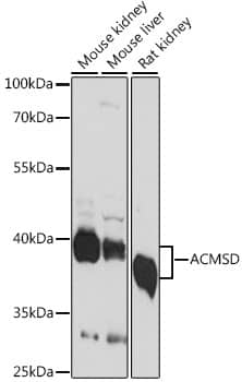 Western Blot: ACMSD Antibody [NBP3-35624] - Western blot analysis of various lysates using ACMSD Rabbit pAb at 1:1000 dilution.Secondary antibody: HRP-conjugated Goat anti-Rabbit IgG (H+L) at 1:10000 dilution.Lysates/proteins: 25ug per lane.Blocking buffer: 3% nonfat dry milk in TBST.Detection: ECL Basic Kit.Exposure time: 10s.