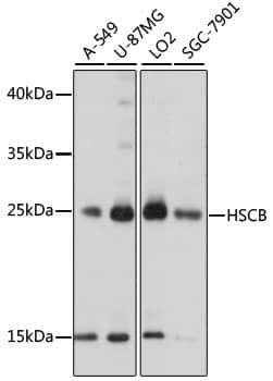 Western Blot: HSCB Antibody [NBP3-35625] - Western blot analysis of various lysates using HSCB Rabbit pAb at 1000 dilution.Secondary antibody: HRP-conjugated Goat anti-Rabbit IgG (H+L) at 1:10000 dilution.Lysates/proteins: 25ug per lane.Blocking buffer: 3% nonfat dry milk in TBST.Detection: ECL Basic Kit.Exposure time: 5s.