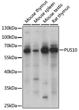 Western Blot: PUS10 Antibody [NBP3-35626] - Western blot analysis of various lysates using PUS10 Rabbit pAb at 1000 dilution.Secondary antibody: HRP-conjugated Goat anti-Rabbit IgG (H+L) at 1:10000 dilution.Lysates/proteins: 25ug per lane.Blocking buffer: 3% nonfat dry milk in TBST.Detection: ECL Basic Kit.Exposure time: 10s.