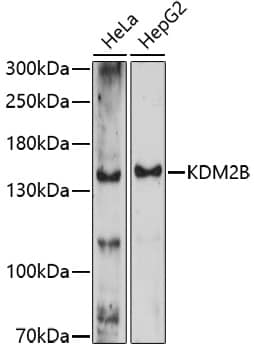 Western Blot: KDM2B Antibody [NBP3-35627] - Western blot analysis of various lysates using KDM2B Rabbit pAb at 1:1000 dilution.Secondary antibody: HRP-conjugated Goat anti-Rabbit IgG (H+L) at 1:10000 dilution.Lysates/proteins: 25ug per lane.Blocking buffer: 3% nonfat dry milk in TBST.Detection: ECL Enhanced Kit.Exposure time: 90s.