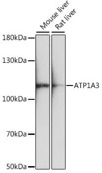 Western Blot: Sodium Potassium ATPase Alpha 3 Antibody [NBP3-35628] - Western blot analysis of various lysates using Sodium Potassium ATPase Alpha 3 Rabbit pAb at 1:1000 dilution.Secondary antibody: HRP-conjugated Goat anti-Rabbit IgG (H+L) at 1:10000 dilution.Lysates/proteins: 25ug per lane.Blocking buffer: 3% nonfat dry milk in TBST.Detection: ECL Basic Kit.Exposure time: 90s.