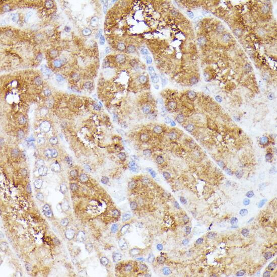 Immunohistochemistry: CLNS1A Antibody [NBP3-35629] - Immunohistochemistry analysis of paraffin-embedded Rat kidney using CLNS1A Rabbit pAb at dilution of 1:100 (40x lens). Microwave antigen retrieval performed with 0.01M PBS Buffer (pH 7.2) prior to IHC staining.