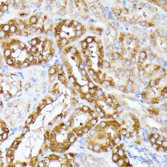 Immunohistochemistry: CLNS1A Antibody [NBP3-35629] - Immunohistochemistry analysis of paraffin-embedded Mouse kidney using CLNS1A Rabbit pAb at dilution of 1:100 (40x lens). Microwave antigen retrieval performed with 0.01M PBS Buffer (pH 7.2) prior to IHC staining.