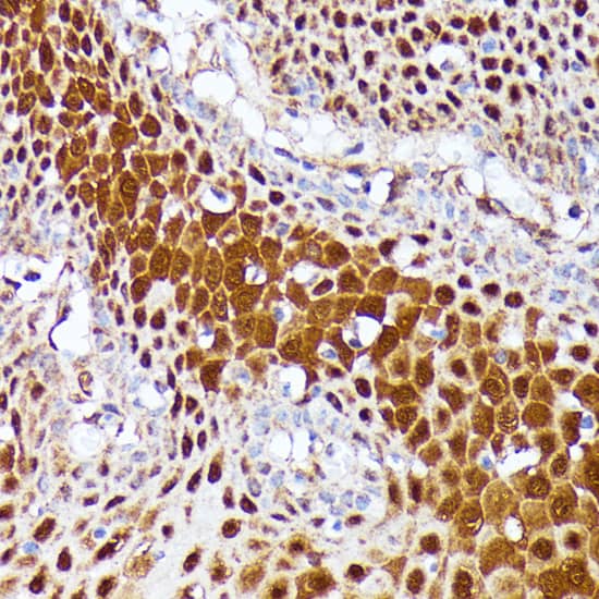 Immunohistochemistry: CLNS1A Antibody [NBP3-35629] - Immunohistochemistry analysis of paraffin-embedded Human esophageal using CLNS1A Rabbit pAb at dilution of 1:100 (40x lens). Microwave antigen retrieval performed with 0.01M PBS Buffer (pH 7.2) prior to IHC staining.