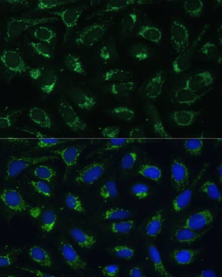 Immunocytochemistry/ Immunofluorescence: ETFB Antibody [NBP3-35630] - Immunofluorescence analysis of U-2 OS cells using ETFB Rabbit pAb at dilution of 1:100 (40x lens). Secondary antibody: Cy3-conjugated Goat anti-Rabbit IgG (H+L) at 1:500 dilution. Blue: DAPI for nuclear staining.