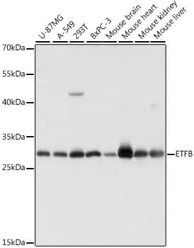 Western Blot: ETFB Antibody [NBP3-35630] - Western blot analysis of various lysates using ETFB Rabbit pAb at 1:1000 dilution.Secondary antibody: HRP-conjugated Goat anti-Rabbit IgG (H+L) at 1:10000 dilution.Lysates/proteins: 25ug per lane.Blocking buffer: 3% nonfat dry milk in TBST.Detection: ECL Basic Kit.Exposure time: 5s.