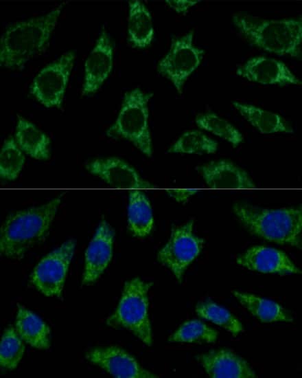 Immunocytochemistry/ Immunofluorescence: ETFB Antibody [NBP3-35630] - Immunofluorescence analysis of L929 cells using ETFB Rabbit pAb at dilution of 1:100 (40x lens). Secondary antibody: Cy3-conjugated Goat anti-Rabbit IgG (H+L) at 1:500 dilution. Blue: DAPI for nuclear staining.