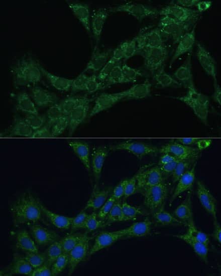 Immunocytochemistry/ Immunofluorescence ETFB Antibody - BSA Free