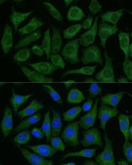 Immunocytochemistry/ Immunofluorescence GRF2 Antibody - BSA Free