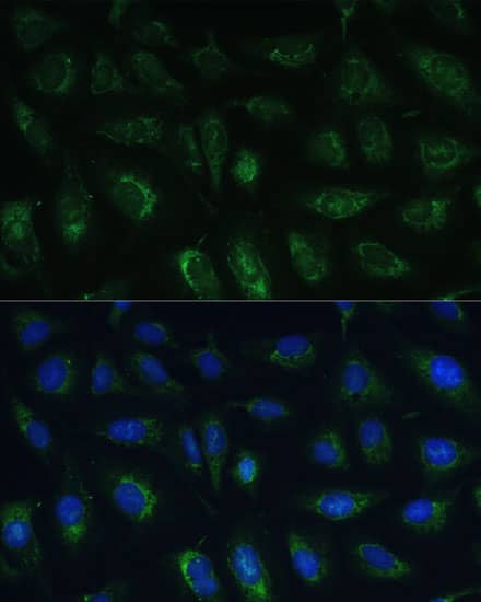 Immunocytochemistry/ Immunofluorescence: GRF2 Antibody [NBP3-35633] - Immunofluorescence analysis of U-2 OS cells using GRF2 Rabbit pAb at dilution of 1:100 (40x lens). Secondary antibody: Cy3-conjugated Goat anti-Rabbit IgG (H+L) at 1:500 dilution. Blue: DAPI for nuclear staining.