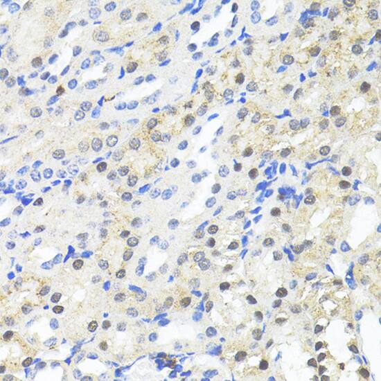 Immunohistochemistry: TRIM27 Antibody [NBP3-35634] - Immunohistochemistry analysis of paraffin-embedded Mouse kidney using TRIM27 Rabbit pAb at dilution of 1:100 (40x lens).Perform microwave antigen retrieval with 10 mM PBS buffer pH 7.2 before commencing with IHC staining protocol.