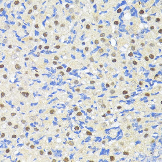 Immunohistochemistry: TRIM27 Antibody [NBP3-35634] - Immunohistochemistry analysis of paraffin-embedded Human liver using TRIM27 Rabbit pAb at dilution of 1:100 (40x lens). Microwave antigen retrieval performed with 0.01M PBS Buffer (pH 7.2) prior to IHC staining.