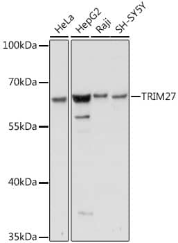 Immunohistochemistry: TRIM27 Antibody [NBP3-35634] - Immunohistochemistry analysis of paraffin-embedded Rat ovary using TRIM27 Rabbit pAb at dilution of 1:100 (40x lens). Microwave antigen retrieval performed with 0.01M PBS Buffer (pH 7.2) prior to IHC staining.