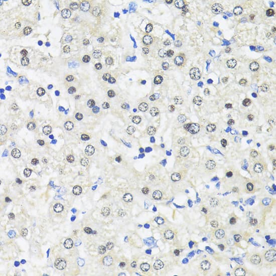 Immunohistochemistry: TRIM27 Antibody [NBP3-35634] - Immunohistochemistry analysis of paraffin-embedded Mouse kidney using TRIM27 Rabbit pAb at dilution of 1:100 (40x lens). Microwave antigen retrieval performed with 0.01M PBS Buffer (pH 7.2) prior to IHC staining.