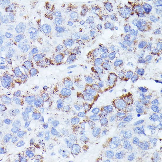 Immunohistochemistry: CCDC6 Antibody [NBP3-35636] - Immunohistochemistry analysis of paraffin-embedded Rat brain using CCDC6 Rabbit pAb at dilution of 1:100 (40x lens). Microwave antigen retrieval performed with 0.01M PBS Buffer (pH 7.2) prior to IHC staining.