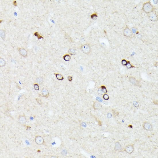 Western Blot: CCDC6 Antibody [NBP3-35636] - Western blot analysis of lysates from HeLa cells using CCDC6 Rabbit pAb at 1:1000 dilution.Secondary antibody: HRP-conjugated Goat anti-Rabbit IgG (H+L) at 1:10000 dilution.Lysates/proteins: 25 ug per lane.Blocking buffer: 3% nonfat dry milk in TBST.Detection: ECL Basic Kit.Exposure time: 60s.