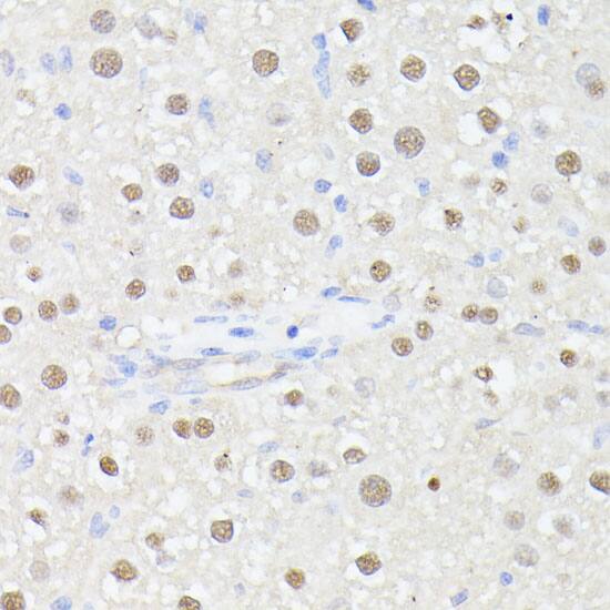 Immunohistochemistry: MLF2 Antibody [NBP3-35637] - Immunohistochemistry analysis of paraffin-embedded Rat liver using MLF2 Rabbit pAb at dilution of 1:100 (40x lens). Microwave antigen retrieval performed with 0.01M PBS Buffer (pH 7.2) prior to IHC staining.