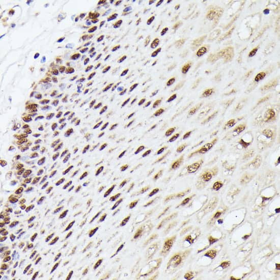 Immunohistochemistry: MLF2 Antibody [NBP3-35637] - Immunohistochemistry analysis of paraffin-embedded Human esophageal using MLF2 Rabbit pAb at dilution of 1:100 (40x lens). Microwave antigen retrieval performed with 0.01M PBS Buffer (pH 7.2) prior to IHC staining.