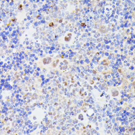 Immunohistochemistry: MLF2 Antibody [NBP3-35637] - Immunohistochemistry analysis of paraffin-embedded Mouse spleen using MLF2 Rabbit pAb at dilution of 1:100 (40x lens). Microwave antigen retrieval performed with 0.01M PBS Buffer (pH 7.2) prior to IHC staining.