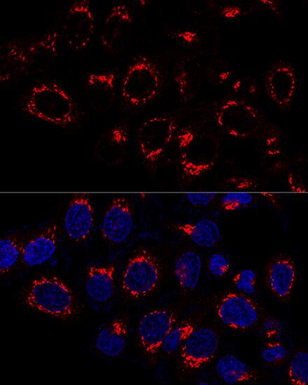 Immunocytochemistry/ Immunofluorescence: VDP p115 Antibody [NBP3-35638] - Confocal immunofluorescence analysis of HeLa cells using VDP p115 Rabbit pAb at dilution of 1:50. Blue: DAPI for nuclear staining.