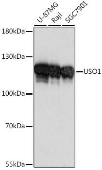 Western Blot: VDP p115 Antibody [NBP3-35638] - Western blot analysis of various lysates using VDP p115 Rabbit pAb at 1:1000 dilution.Secondary antibody: HRP-conjugated Goat anti-Rabbit IgG (H+L) at 1:10000 dilution.Lysates/proteins: 25ug per lane.Blocking buffer: 3% nonfat dry milk in TBST.Detection: ECL Basic Kit.Exposure time: 1s.