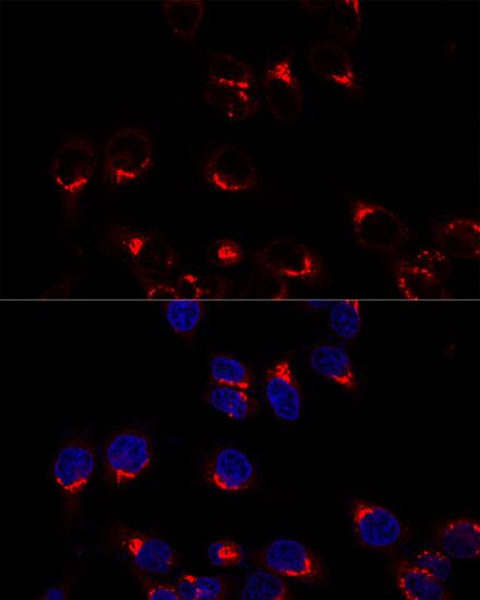 Immunocytochemistry/ Immunofluorescence: VDP p115 Antibody [NBP3-35638] - Confocal immunofluorescence analysis of Hela cells using VDP p115 Rabbit pAb at dilution of 1:200. Blue: DAPI for nuclear staining.