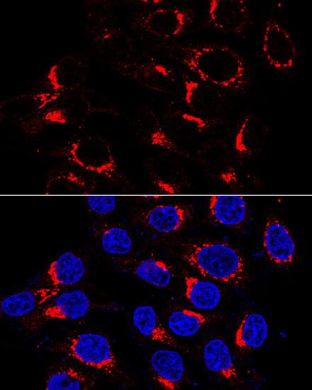 Immunocytochemistry/ Immunofluorescence: VDP p115 Antibody [NBP3-35638] - Immunofluorescence analysis of HeLa cells using VDP p115 Rabbit pAb at dilution of 1:200 (60x lens). Blue: DAPI for nuclear staining.