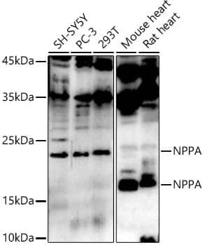 Western Blot: Atrial Natriuretic Peptide/ANP Antibody [NBP3-35642] - Western blot analysis of various lysates using Atrial Natriuretic Peptide/ANP Rabbit pAb at 1:1000 dilution.Secondary antibody: HRP-conjugated Goat anti-Rabbit IgG (H+L) at 1:10000 dilution.Lysates/proteins: 25ug per lane.Blocking buffer: 3% nonfat dry milk in TBST.Detection: ECL Enhanced Kit.Exposure time: 90s.