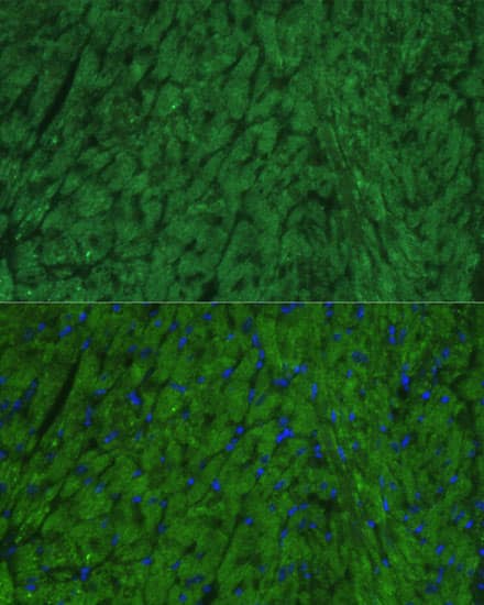 Immunocytochemistry/ Immunofluorescence: Atrial Natriuretic Peptide/ANP Antibody [NBP3-35642] - Immunofluorescence analysis of paraffin-embedded mouse heart using Atrial Natriuretic Peptide/ANP Rabbit pAb at dilution of 1:100. Secondary antibody: Cy3-conjugated Goat anti-Rabbit IgG (H+L) at 1:500 dilution. Blue: DAPI for nuclear staining.