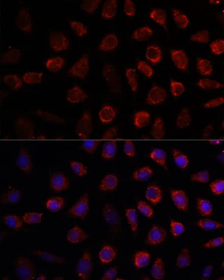 Immunocytochemistry/ Immunofluorescence: PDE11A Antibody [NBP3-35648] - Immunofluorescence analysis of L929 cells using PDE11A Rabbit pAb at dilution of 1:100. Secondary antibody: Cy3-conjugated Goat anti-Rabbit IgG (H+L) at 1:500 dilution. Blue: DAPI for nuclear staining.