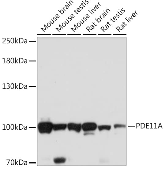 Western Blot: PDE11A Antibody [NBP3-35648] - Western blot analysis of various lysates using PDE11A Rabbit pAb at 1:1000 dilution.Secondary antibody: HRP-conjugated Goat anti-Rabbit IgG (H+L) at 1:10000 dilution.Lysates/proteins: 25ug per lane.Blocking buffer: 3% nonfat dry milk in TBST.Detection: ECL Basic Kit.Exposure time: 1s.