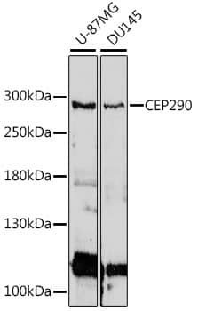 Western Blot: CEP290 Antibody [NBP3-35649] - Western blot analysis of various lysates using CEP290 Rabbit pAb at 1:1000 dilution.Secondary antibody: HRP-conjugated Goat anti-Rabbit IgG (H+L) at 1:10000 dilution.Lysates/proteins: 25ug per lane.Blocking buffer: 3% nonfat dry milk in TBST.Detection: ECL Basic Kit.Exposure time: 30s.