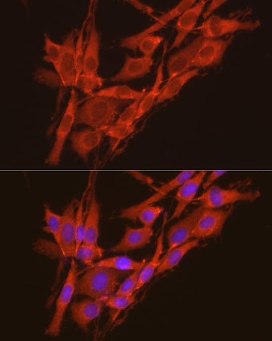 Immunocytochemistry/ Immunofluorescence: CKII alpha prime polypeptide Antibody [NBP3-35650] - Immunofluorescence analysis of PC-12 cells using CKII alpha prime polypeptide Rabbit pAb at dilution of 1:100 (40x lens). Secondary antibody: Cy3-conjugated Goat anti-Rabbit IgG (H+L) at 1:500 dilution. Blue: DAPI for nuclear staining.