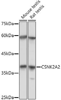 Western Blot: CKII alpha prime polypeptide Antibody [NBP3-35650] - Western blot analysis of various lysates using CKII alpha prime polypeptide Rabbit pAb at 1:1000 dilution.Secondary antibody: HRP-conjugated Goat anti-Rabbit IgG (H+L) at 1:10000 dilution.Lysates/proteins: 25ug per lane.Blocking buffer: 3% nonfat dry milk in TBST.Detection: ECL Basic Kit.Exposure time: 30s.