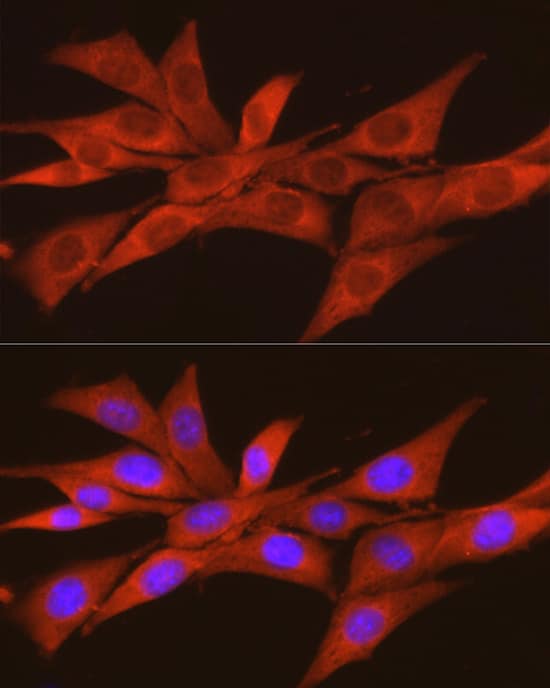 Immunocytochemistry/ Immunofluorescence: CKII alpha prime polypeptide Antibody [NBP3-35650] - Immunofluorescence analysis of NIH/3T3 cells using CKII alpha prime polypeptide Rabbit pAb at dilution of 1:100 (40x lens). Secondary antibody: Cy3-conjugated Goat anti-Rabbit IgG (H+L) at 1:500 dilution. Blue: DAPI for nuclear staining.