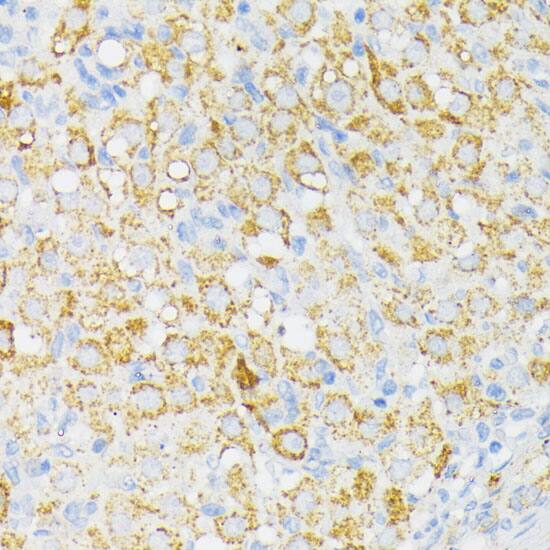 Immunohistochemistry: USP33 Antibody [NBP3-35652] - Immunohistochemistry analysis of paraffin-embedded Rat ovary using USP33 Rabbit pAb at dilution of 1:100 (40x lens). Microwave antigen retrieval performed with 0.01M PBS Buffer (pH 7.2) prior to IHC staining.