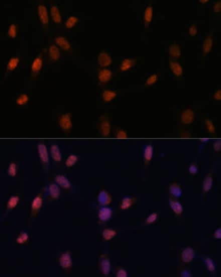 Immunocytochemistry/ Immunofluorescence: USP33 Antibody [NBP3-35652] - Immunofluorescence analysis of NIH-3T3 cells using USP33 Rabbit pAb at dilution of 1:100 (40x lens). Secondary antibody: Cy3-conjugated Goat anti-Rabbit IgG (H+L) at 1:500 dilution. Blue: DAPI for nuclear staining.