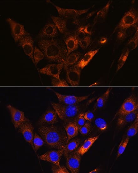 Immunocytochemistry/ Immunofluorescence: HCN1 Antibody [NBP3-35653] - Immunofluorescence analysis of NIH/3T3 cells using HCN1 Rabbit pAb at dilution of 1:100. Secondary antibody: Cy3-conjugated Goat anti-Rabbit IgG (H+L) at 1:500 dilution. Blue: DAPI for nuclear staining.