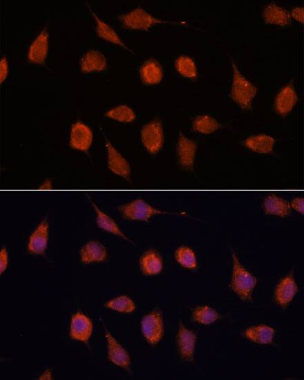 Immunocytochemistry/ Immunofluorescence: KvBeta2 Antibody [NBP3-35654] - Immunofluorescence analysis of L929 cells using KvBeta2 Rabbit pAb at dilution of 1:100. Secondary antibody: Cy3-conjugated Goat anti-Rabbit IgG (H+L) at 1:500 dilution. Blue: DAPI for nuclear staining.