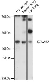 Western Blot: KvBeta2 Antibody [NBP3-35654] - Western blot analysis of various lysates using KvBeta2 Rabbit pAb at 1:1000 dilution.Secondary antibody: HRP-conjugated Goat anti-Rabbit IgG (H+L) at 1:10000 dilution.Lysates/proteins: 25ug per lane.Blocking buffer: 3% nonfat dry milk in TBST.Detection: ECL Basic Kit.Exposure time: 180s.