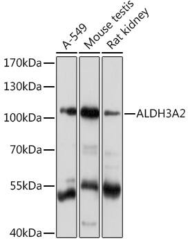 Western Blot: FALDH Antibody [NBP3-35657] - Western blot analysis of various lysates using FALDH Rabbit pAb at 1:1000 dilution.Secondary antibody: HRP-conjugated Goat anti-Rabbit IgG (H+L) at 1:10000 dilution.Lysates/proteins: 25ug per lane.Blocking buffer: 3% nonfat dry milk in TBST.Detection: ECL Basic Kit.Exposure time: 5s.