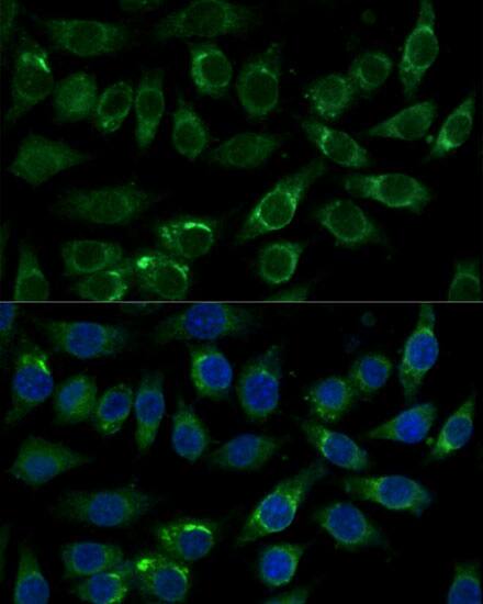 Western Blot: FALDH Antibody [NBP3-35657] - Western blot analysis of lysates from A549 cells using FALDH Rabbit pAb at 1:1000 dilution incubated overnight at 4C.Secondary antibody: HRP-conjugated Goat anti-Rabbit IgG (H+L) at 1:10000 dilution.Lysates/proteins: 25 ug per lane.Blocking buffer: 3% nonfat dry milk in TBST.Detection: ECL Basic Kit.Exposure time: 30s.