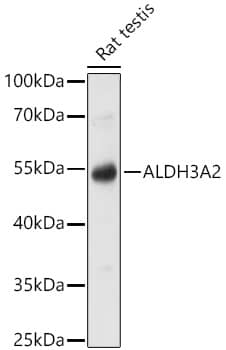 Western Blot: FALDH Antibody [NBP3-35657] - Western Blot analysis of lysates from Rat testis using FALDH Rabbit pAb at 1:1000 dilution incubated overnight at 4C.Secondary antibody: HRP-conjugated Goat anti-Rabbit IgG (H+L) at 1:10000 dilution.Lysates/proteins: 25 ug per lane.Blocking buffer: 3% nonfat dry milk in TBST.Detection: ECL Basic Kit.Exposure time: 5s.