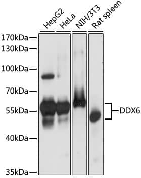 Western Blot: DDX6 Antibody [NBP3-35658] - Western blot analysis of various lysates using DDX6 Rabbit pAb at 1:1000 dilution.Secondary antibody: HRP-conjugated Goat anti-Rabbit IgG (H+L) at 1:10000 dilution.Lysates/proteins: 25ug per lane.Blocking buffer: 3% nonfat dry milk in TBST.Detection: ECL Basic Kit.Exposure time: 1s.