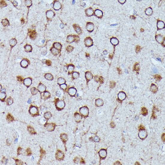 Immunohistochemistry: DDX6 Antibody [NBP3-35658] - Immunohistochemistry analysis of paraffin-embedded Rat brain using DDX6 Rabbit pAb at dilution of 1:100 (40x lens). Microwave antigen retrieval performed with 0.01M PBS Buffer (pH 7.2) prior to IHC staining.