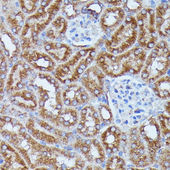 Immunohistochemistry: DDX6 Antibody [NBP3-35658] - Immunohistochemistry analysis of paraffin-embedded Mouse kidney using DDX6 Rabbit pAb at dilution of 1:100 (40x lens). Microwave antigen retrieval performed with 0.01M PBS Buffer (pH 7.2) prior to IHC staining.