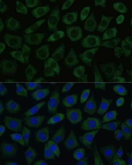 Immunocytochemistry/ Immunofluorescence: DDX6 Antibody [NBP3-35658] - Immunofluorescence analysis of L929 cells using DDX6 Rabbit pAb at dilution of 1:100 (40x lens). Secondary antibody: Cy3-conjugated Goat anti-Rabbit IgG (H+L) at 1:500 dilution. Blue: DAPI for nuclear staining.