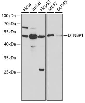 Western Blot: Dysbindin Antibody [NBP3-35661] - Western blot analysis of various lysates using Dysbindin Rabbit pAb at 1:1000 dilution.Secondary antibody: HRP-conjugated Goat anti-Rabbit IgG (H+L) at 1:10000 dilution.Lysates/proteins: 25ug per lane.Blocking buffer: 3% nonfat dry milk in TBST.