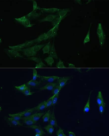 Immunocytochemistry/ Immunofluorescence: ARL3 Antibody [NBP3-35662] - Immunofluorescence analysis of C6 cells using ARL3 Rabbit pAb at dilution of 1:100 (40x lens). Secondary antibody: Cy3-conjugated Goat anti-Rabbit IgG (H+L) at 1:500 dilution. Blue: DAPI for nuclear staining.