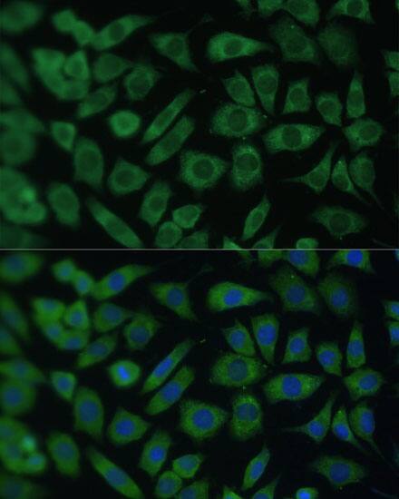 Immunocytochemistry/ Immunofluorescence: ARL3 Antibody [NBP3-35662] - Immunofluorescence analysis of L929 cells using ARL3 Rabbit pAb at dilution of 1:100 (40x lens). Secondary antibody: Cy3-conjugated Goat anti-Rabbit IgG (H+L) at 1:500 dilution. Blue: DAPI for nuclear staining.